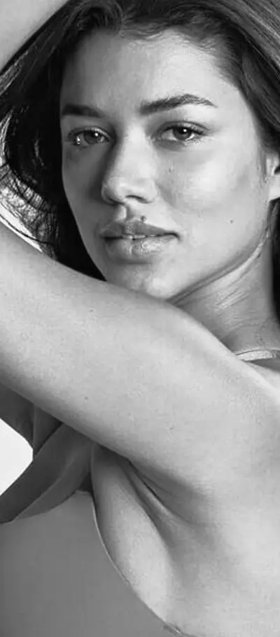 EXCESSIVE SWEATING